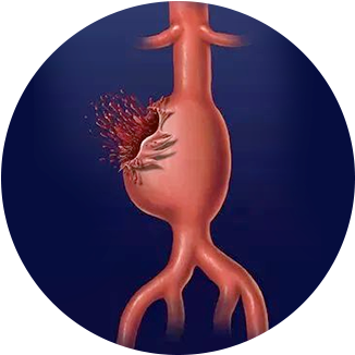 blood-vessels