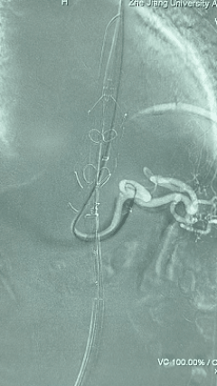 3.gif