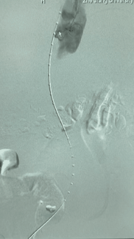 compressed_1770972515230.gif